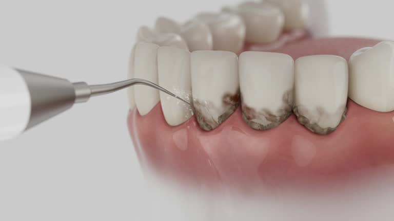 Reliable Dental Implants contractor in Calhoun County County, SC by Dentist Open Now